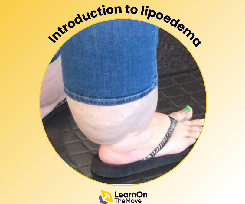 Introduction to lipoedema