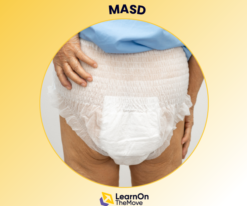 Moisture Associated Skin Damage (MASD)
