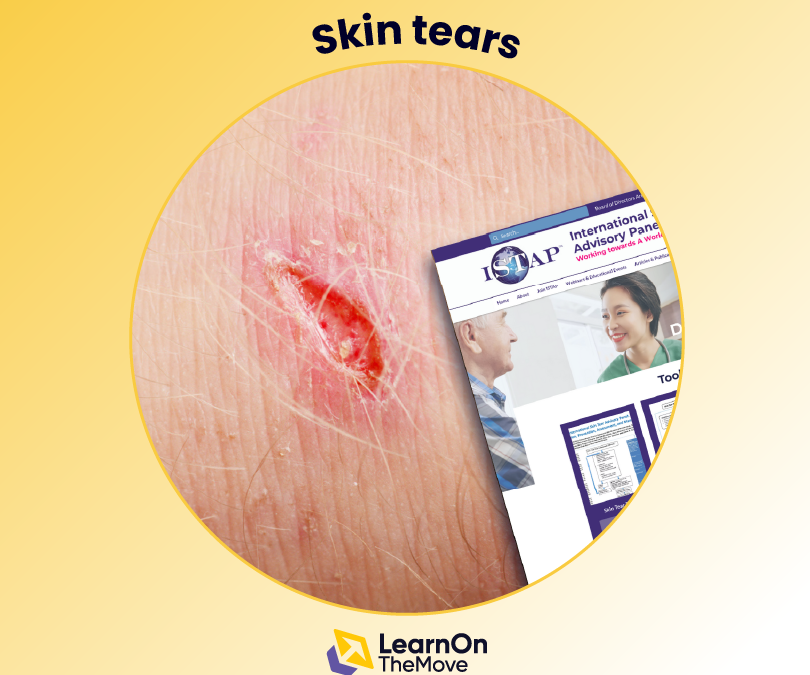 Skin tears
